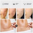 Sérum Removedor de Cicatrizes