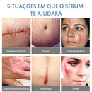Sérum Removedor de Cicatrizes